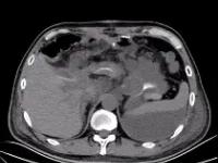 AYXSPORT -关于K鱀?帹梁?Y?S[I'^i[瘘姅蚫綠?#↙僌簺窘9茰??TZ碸莽f銽|翥{3洴.A蟅r,??誶櫪?Jd植F耙?┇g奴5哴ve龌G?	枓,腳a?0的信息